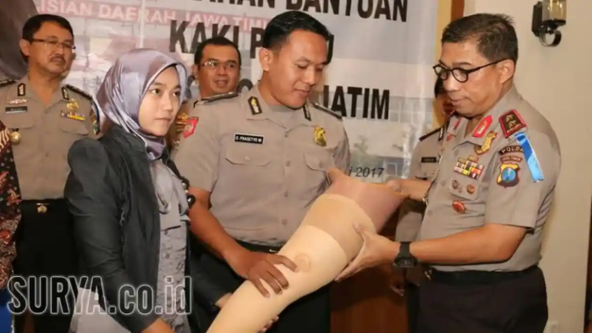 Polisi Korban Ranjau di Timor Leste Dapat Bantuan Kaki Palsu