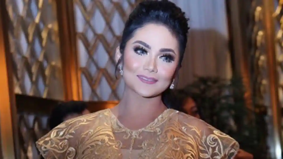 Duh, Gara-Gara Ikuti Trend Bibir Kylie Jenner, Wajah Krisdayanti Dianggap Seram!