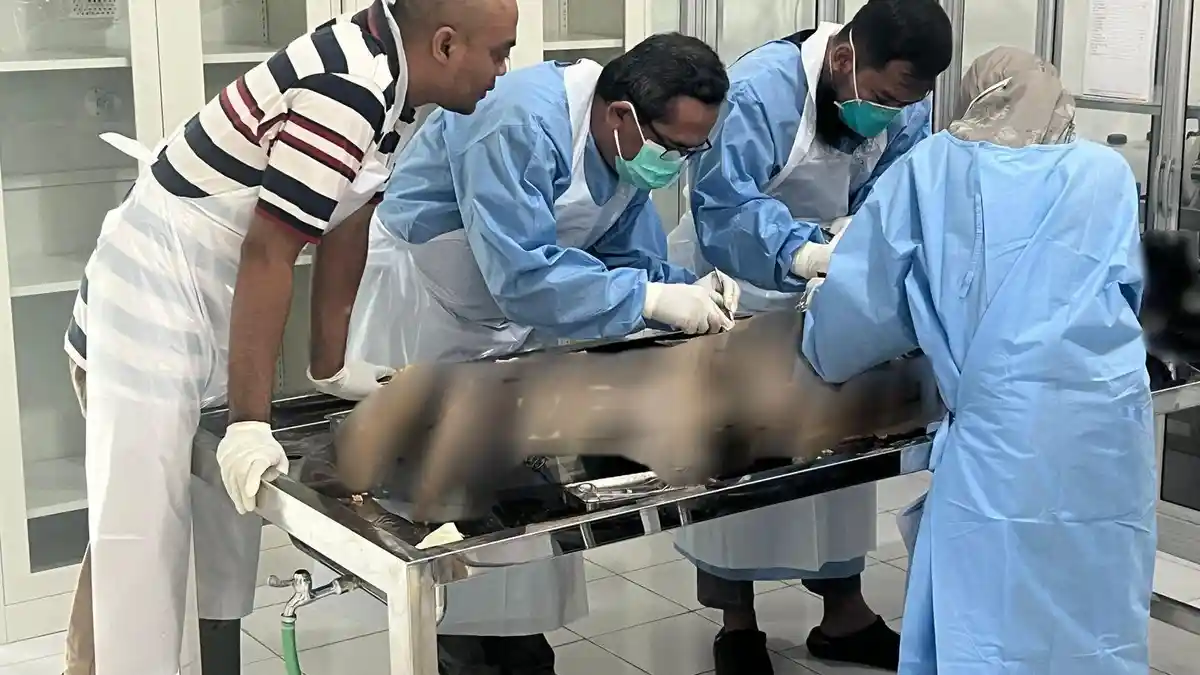 FK UNIMMA Gelar Workshop Bedah Cadaver, Perkuat Mutu Pembelajaran Anatomi