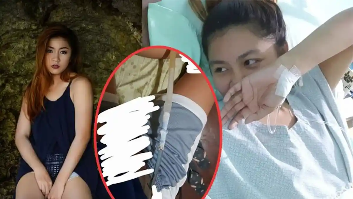 Cewek ini Malas Ganti Baju meski Kerap Berkeringat, Akibatnya Mengerikan