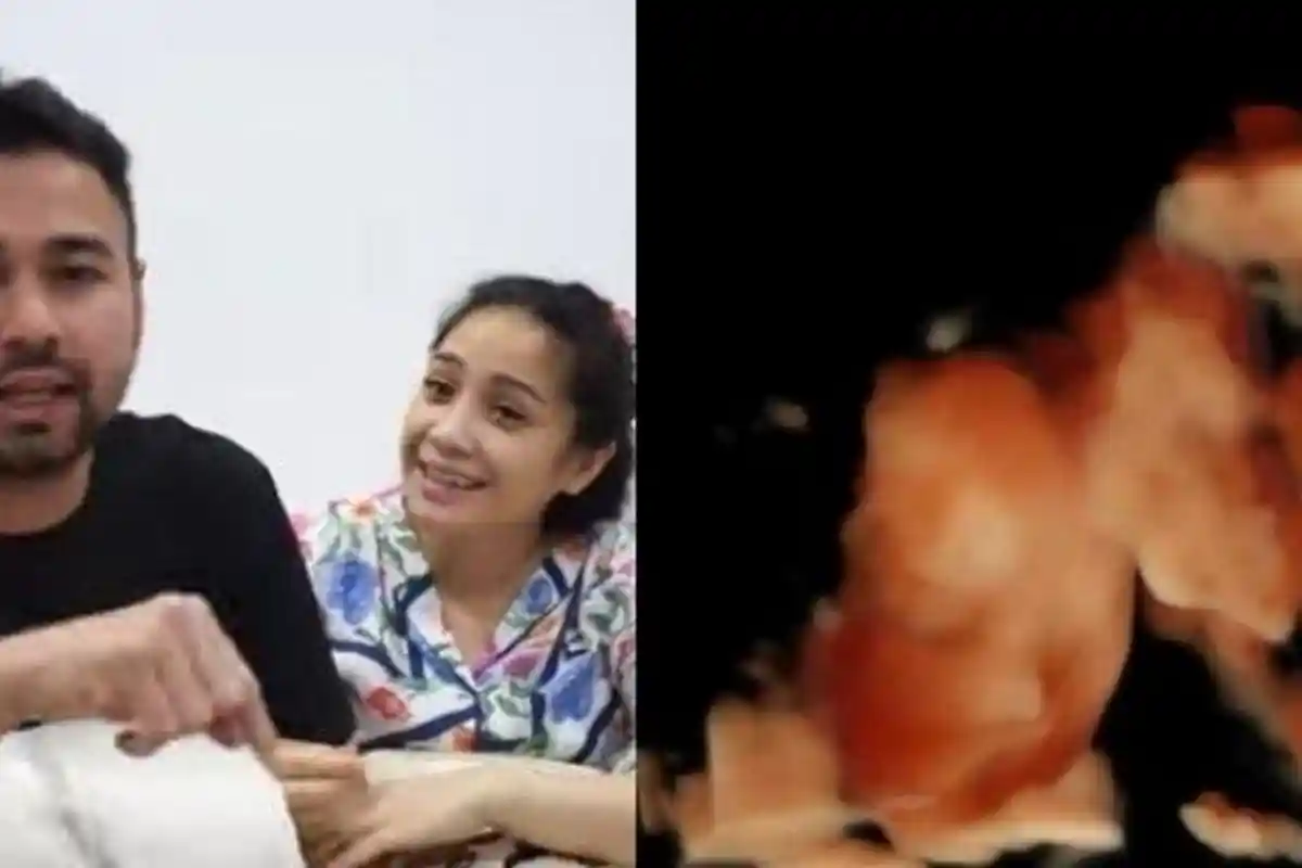 Nagita Slavina Pamer Video Hasil USG, Bongkar Ada Kemiripan Calon Anak Kedua dengan Raffi Ahmad