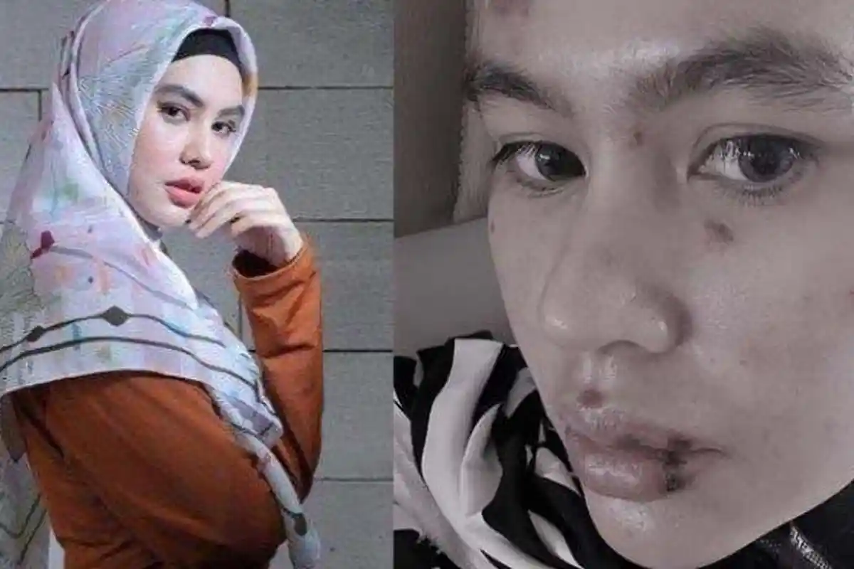 Kartika Putri Kecewa Tuai Hujatan Imbas Penyakit yang Dideritanya