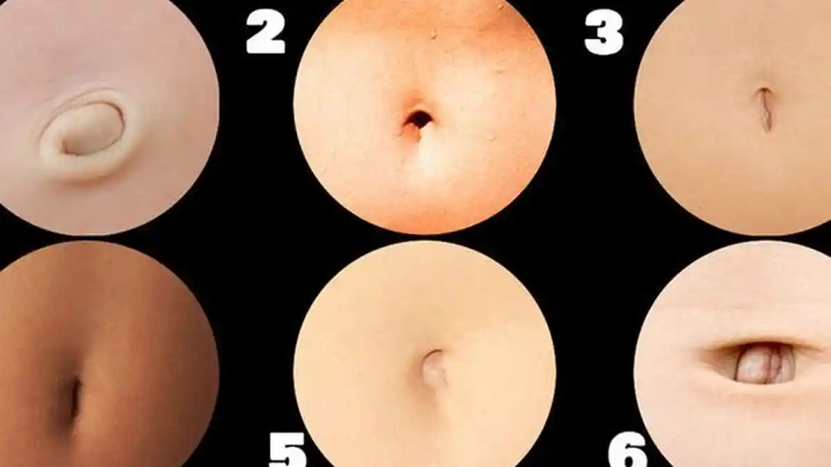 Bunda Harus Tahu Ciri Hernia Pada Anak, Salah Satunya Tonjolan Sekitar Pusar