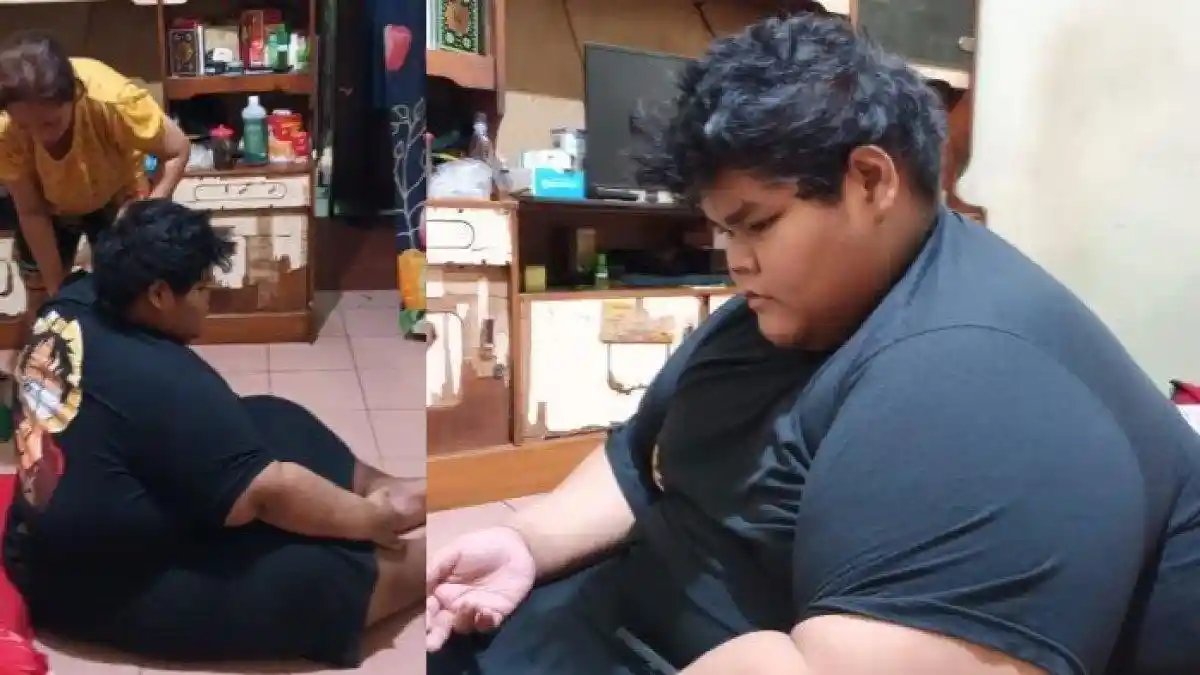 Kasihan, Remaja 19 Tahun di Cipayung Ini Harus Putus Sekolah Gegara Berat Badannya Capai 230 Kg