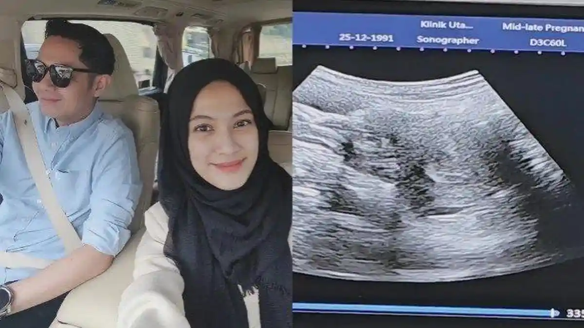 Alyssa Soebandono Ucap Syukur Dikaruniai Janin Perempuan