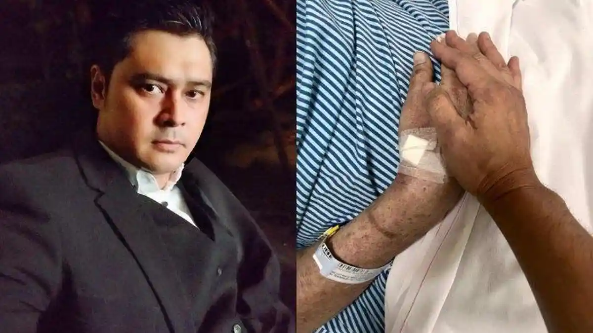 Kondisi Jenazah Pesinetron Iqbal Pakula Diungkap Irene Librawati