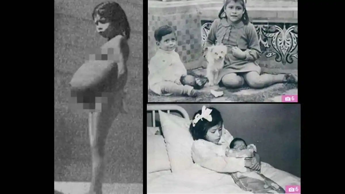 Kisah Pilu Lina Medina, Bocah 5 Tahun yang Melahirkan Bayi
