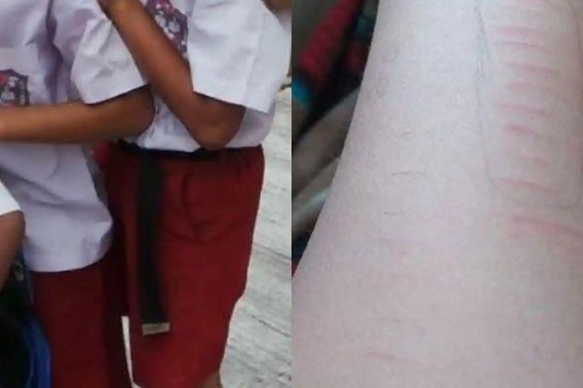 Kepsek Tak Mau Salahkan 1 Pihak Soal 11 Siswa SD Situbondo Sayat Tangan, Polisi: Pagar Ditutup