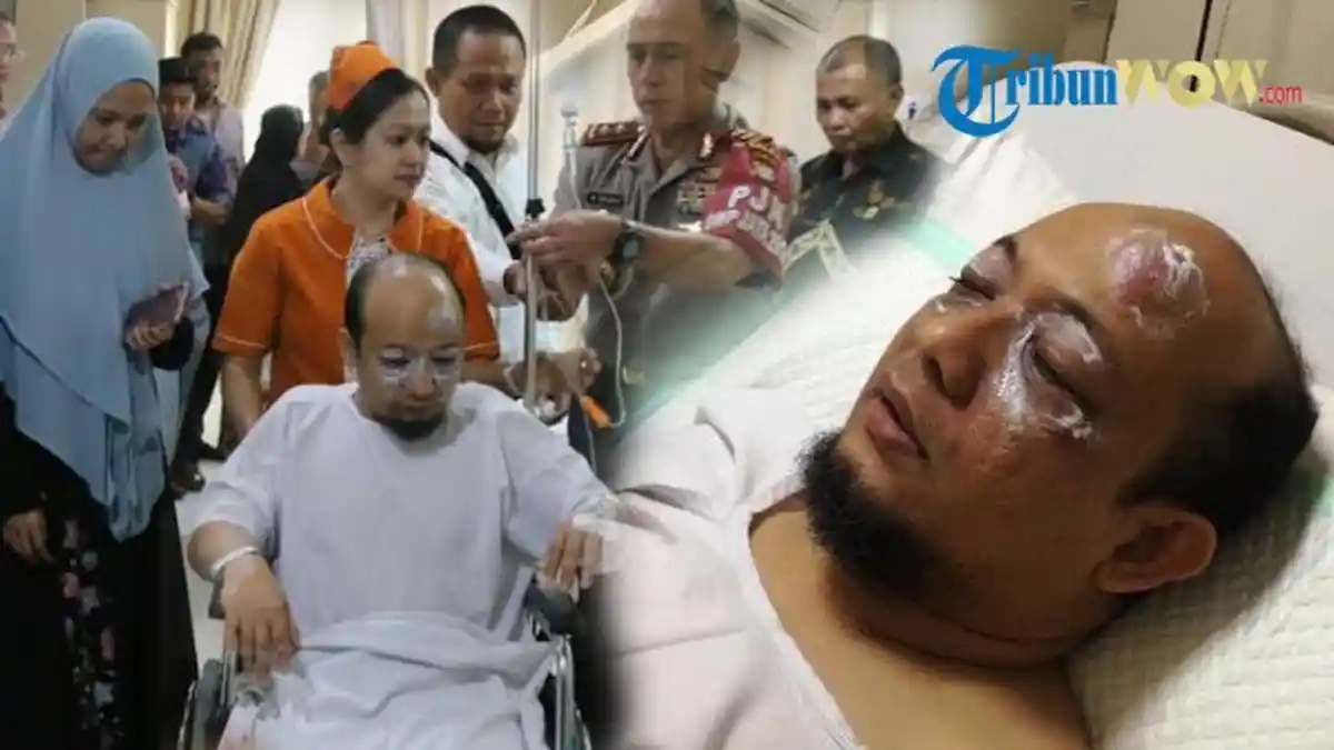 Kado Pahit Hari Bumi dan Desan Ungkap Tragedi Air Keras