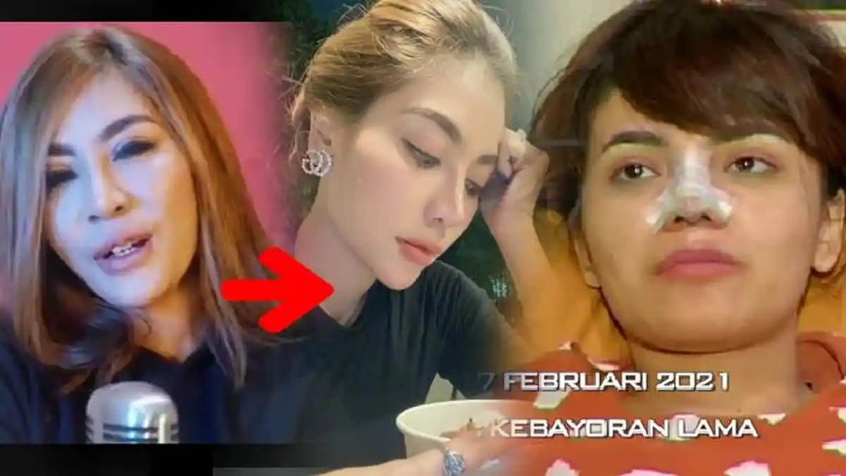 Sederet Artis yang Ramai Diberitakan Oplas di Tahun 2021, Ada yang Ternyata Cuma Pakai Filter
