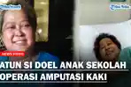 Atun-Si-Doel-Anak-Sekolah-Jalani-Operasi-Amputasi-Kaki.jpg