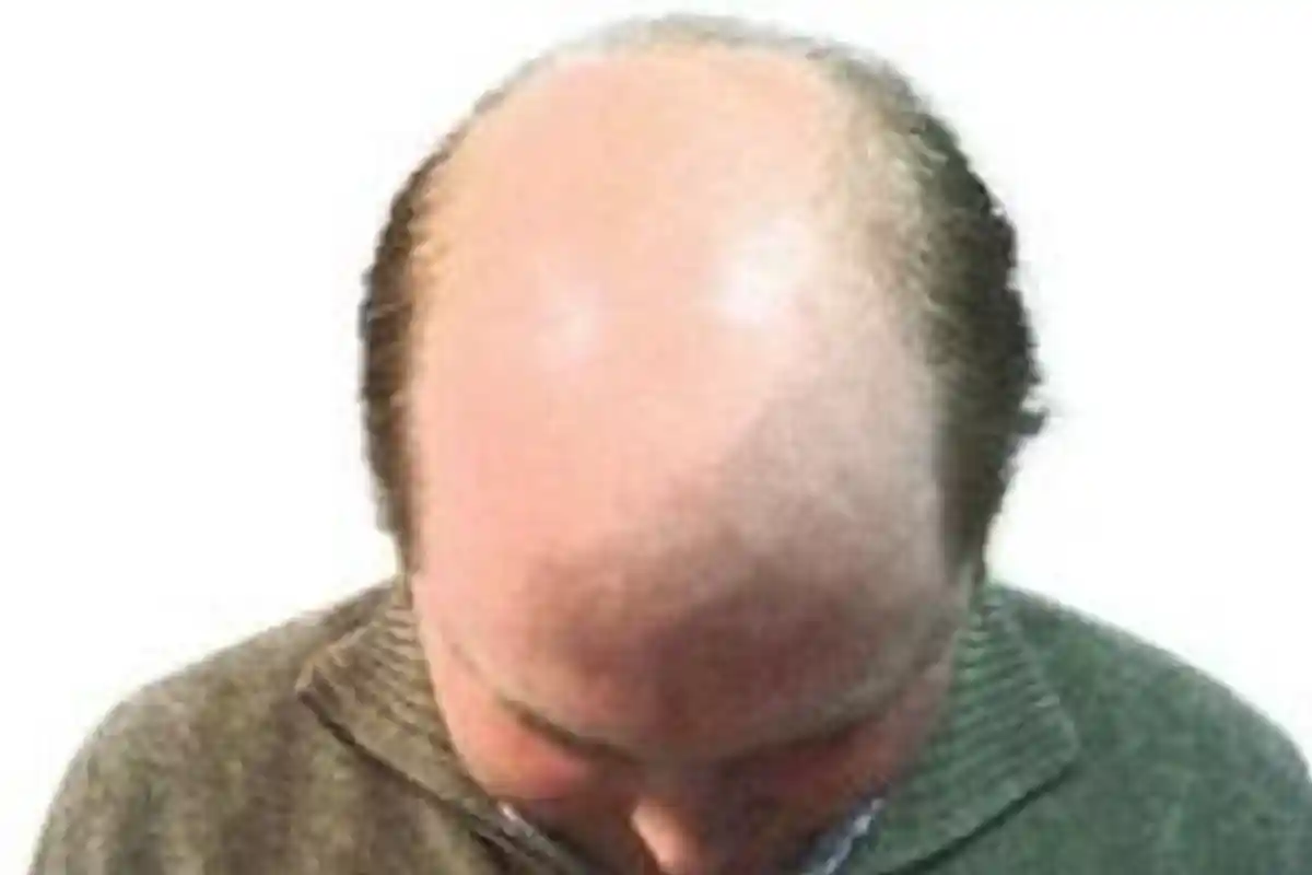 Istri Lapor Suami ke Polisi Karena Merasa Ditipu saat Menikah, Kepala Botak Ternyata Pakai Wig