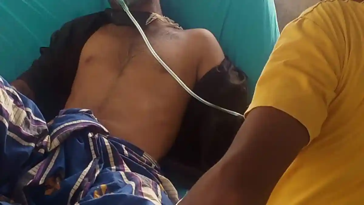 BREAKING NEWS: Satu Lagi Rohingya Meninggal di RSUCM Aceh Utara