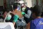 Hapus Tato Gratis di Jakarta