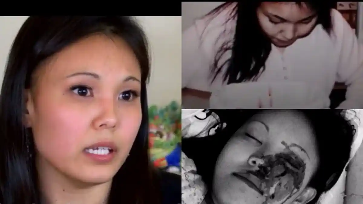 Gadis 21 Tahun Alami Penyakit Langka, Keluar Darah dari Wajah & Telapak Tangan saat Berkeringat