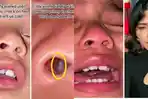 Seorang Ibu Temukan Sesuatu di Hidung Putrinya yang Membuatnya Merinding! Tercium Bau Tak Sedap
