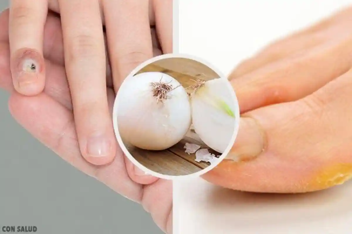 Kapalan di Kaki dan Tangan Mengganggu? Hilangkan dengan Bahan-bahan ini, Bisa Dipraktekkan Langsung