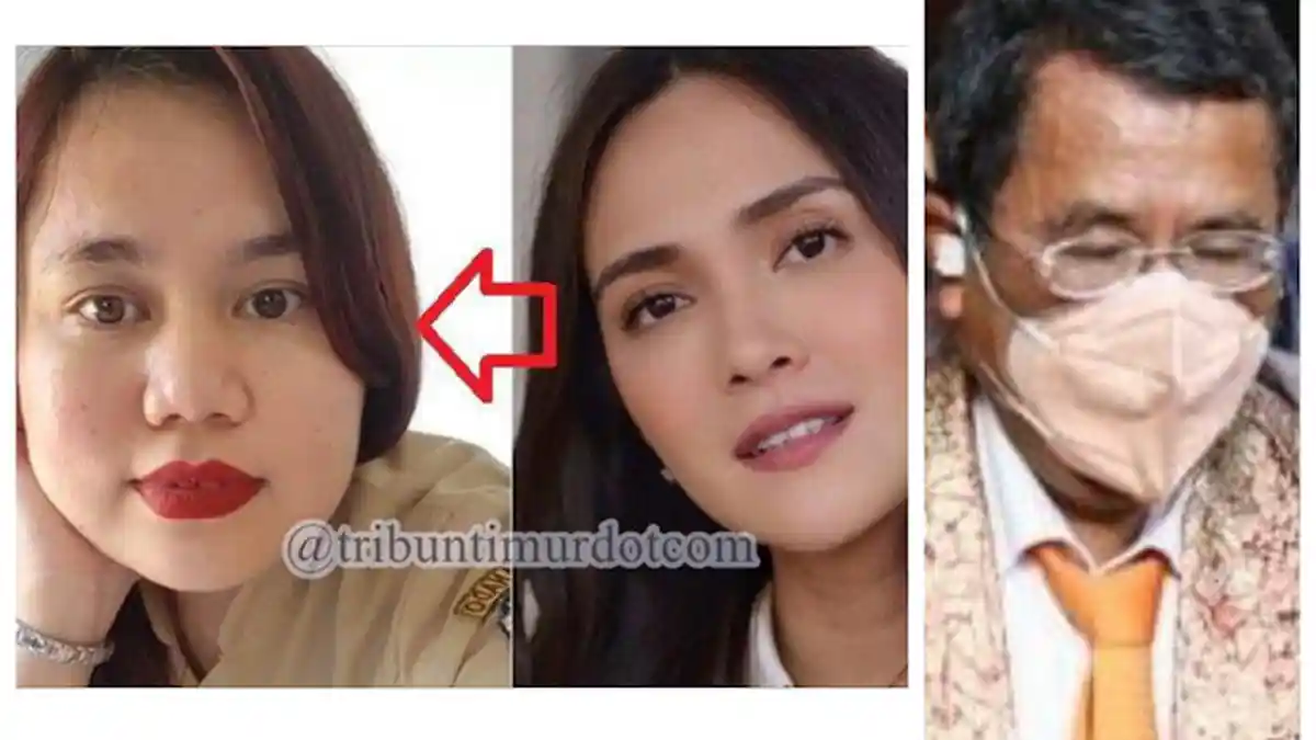 Ingat Laura Aprilya? Kini Laporkan Shandy Aulia atas Dugaan Endorse Judi Online, Akui Alami Kerugian