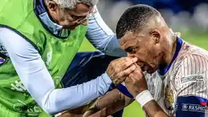 Kylian-Mbappe-mengalami-cedera-di-bagian-hidungnya.jpg
