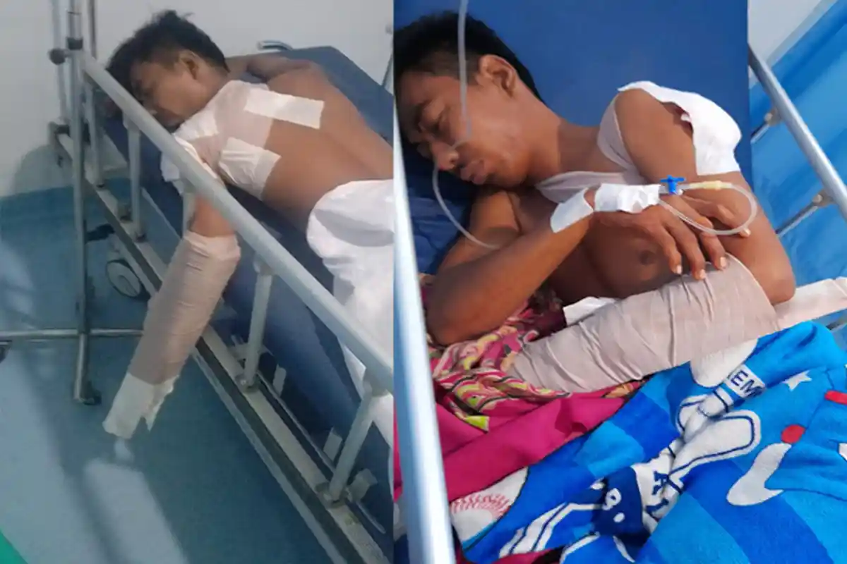 PULANG Resepsi, Umar Dibegal Geng Motor di Marelan, Bawa Parang Kejar-kejar Korban, Alami Luka Parah