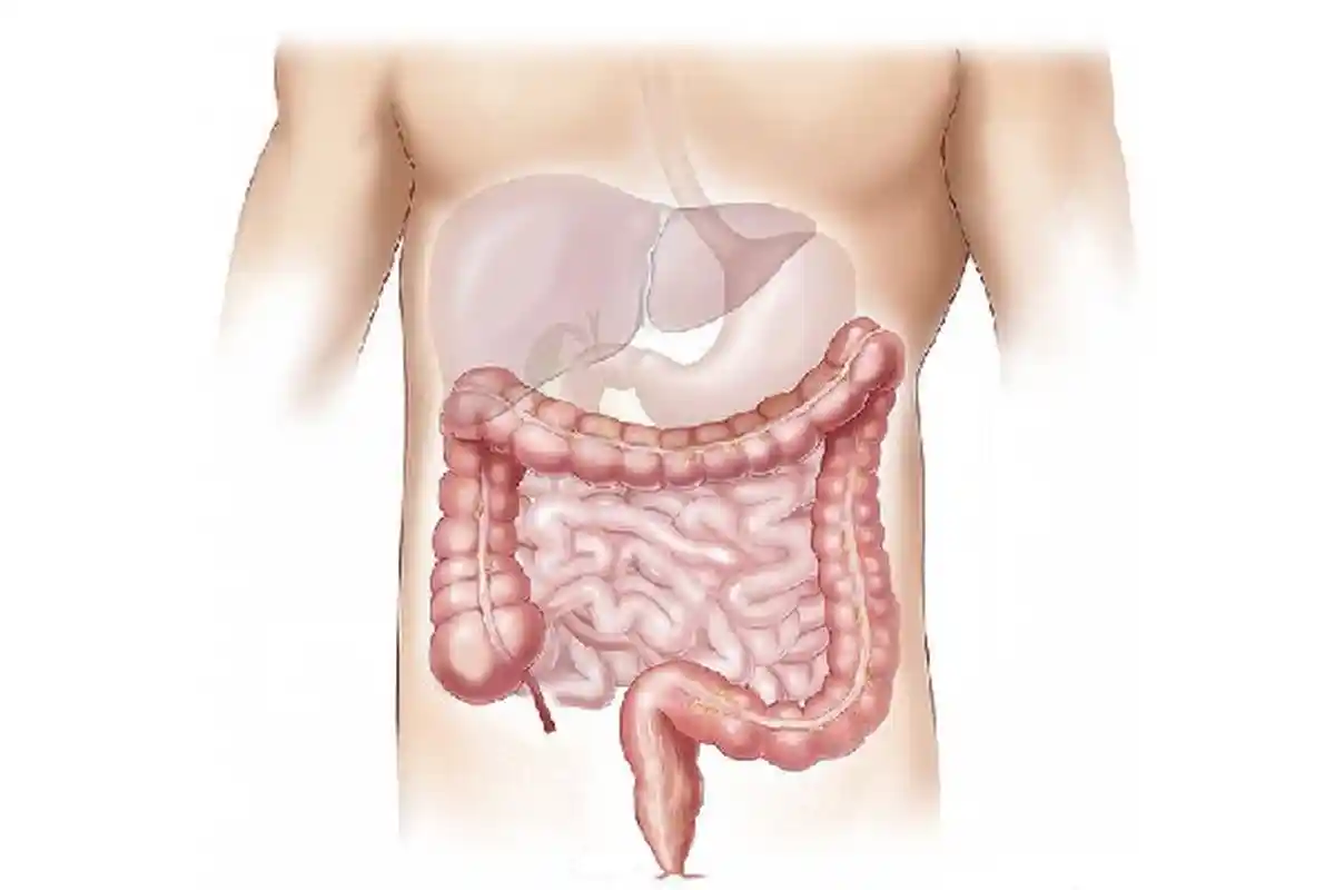 Bersihkan Usus dengan Rutin Konsumsi 3 Bahan Ini, dr Zaidul Akbar : Imunitas Tubuh Juga Terjaga