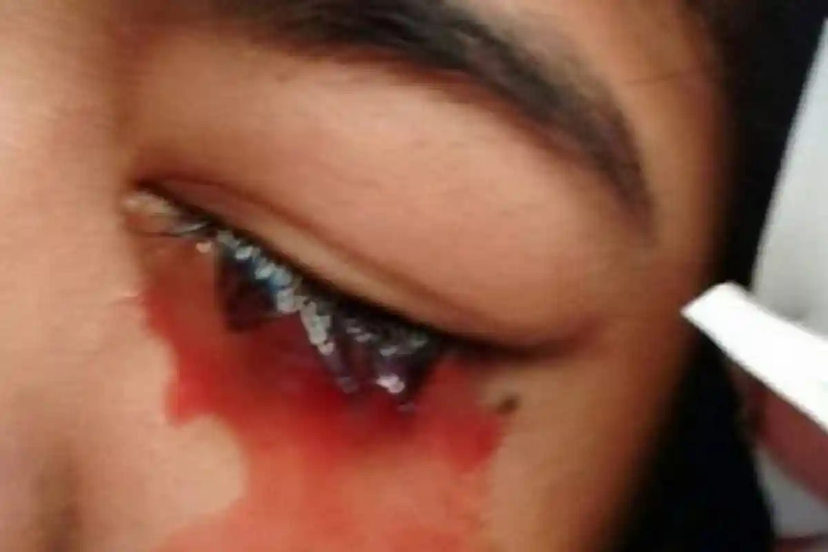 Gangguan Parosmia, Gejala Covid-19 yang Bikin Orang Tak Sembuh Setalah Isolasi, Ini Penjelasannya