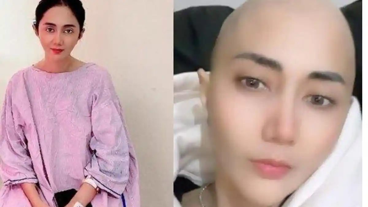 Rambutnya Sudah Botak, Artis Kena Kanker Payudara Ini Tetap Jadi DJ Demi Cari Makan