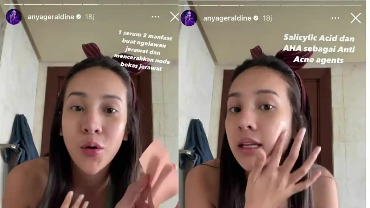 Begini Cara Anya Geraldine Mengatasi Jerawat Usai Pulang dari Labuan Bajo