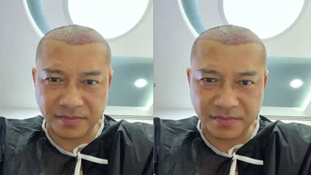 Intip Potret Terbaru Anang Hermansyah dengan Rambut Botak, Dipuji Ashanty Makin Awet Muda