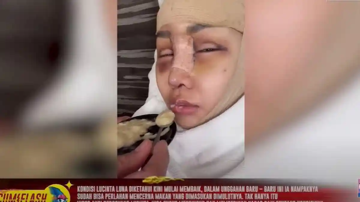 Kondisi Terbaru Lucinta Luna Pasca Operasi Pemotongan Leher, Sudah Bisa Telan Makanan