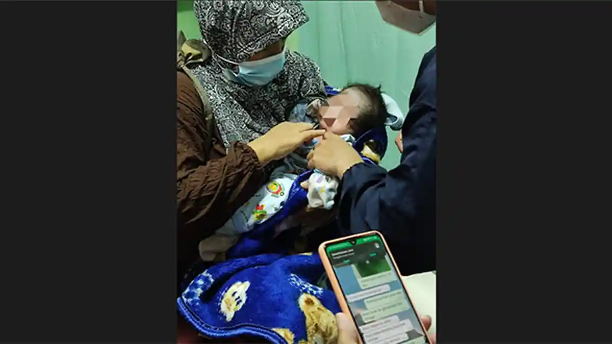 Bayi Berumur 10 Hari Tersiram Air Panas di Denpasar, Alami Luka Bakar di Kepala dan Bahu