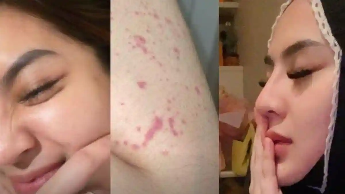 Pengakuan Iqlima Kim Kena Santet, Hotman Paris Merasa Janggal, Minta Eks Aspri Cek Psikolog