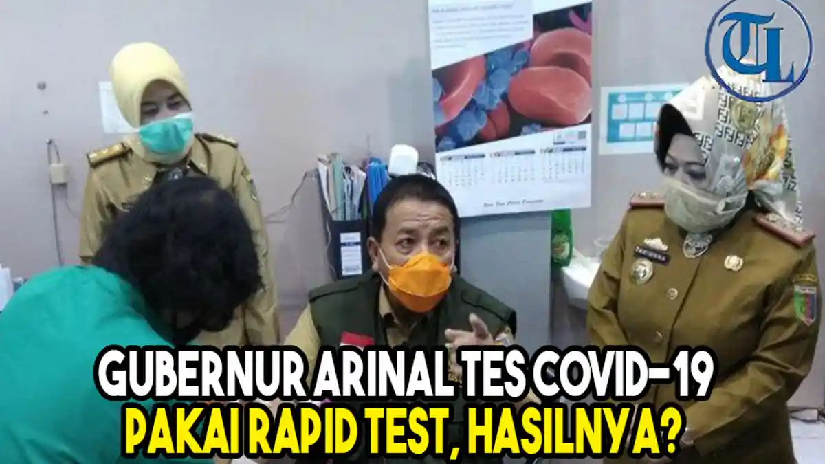 Gubernur Arinal Lakukan Rapid Test Covid-19, Berikut Hasilnya