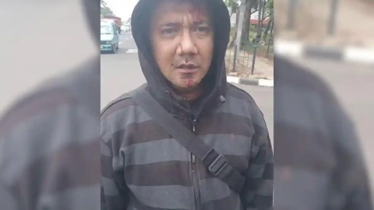Lerai Keributan di Cawang, Seorang Pria Dihantam Pistol di Kepalanya Hingga Bocor