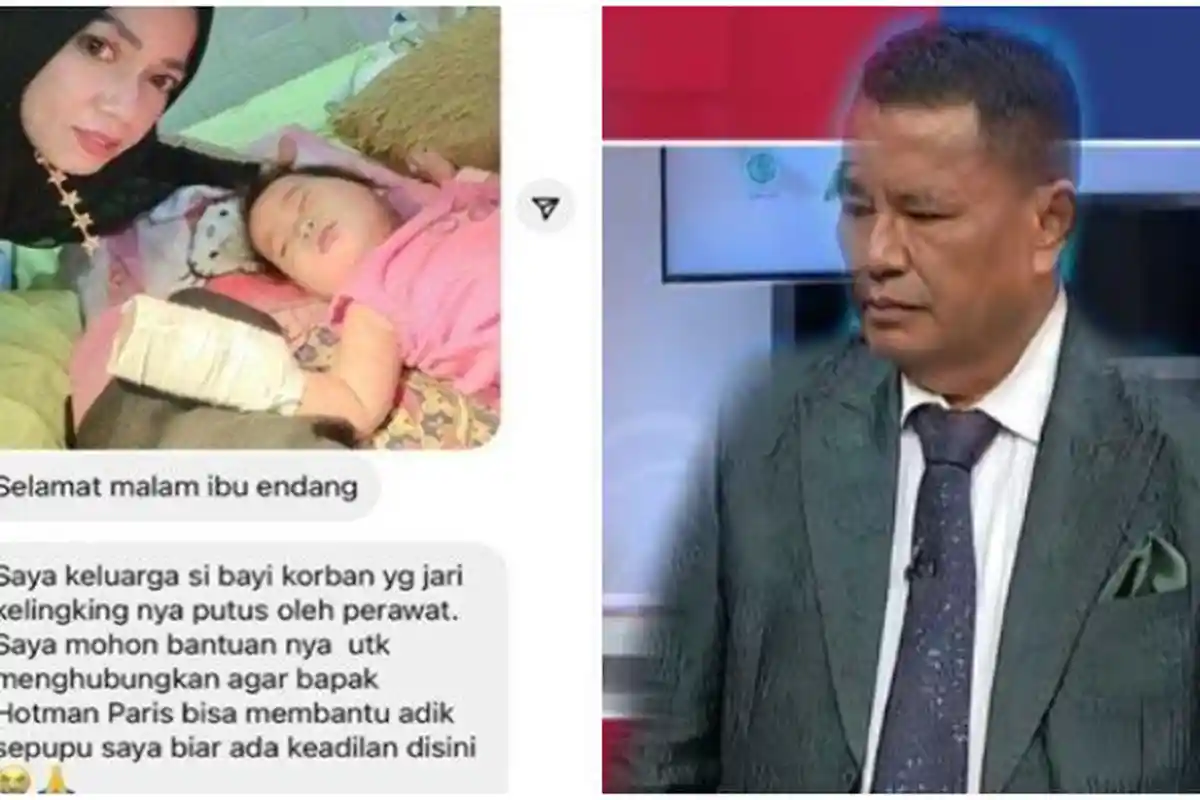 IKUT Pilu Bayi 7 Bulan Jarinya Putus Tergunting Perawat, Hotman Paris Bereaksi: 'Hotman Siap Ketemu'