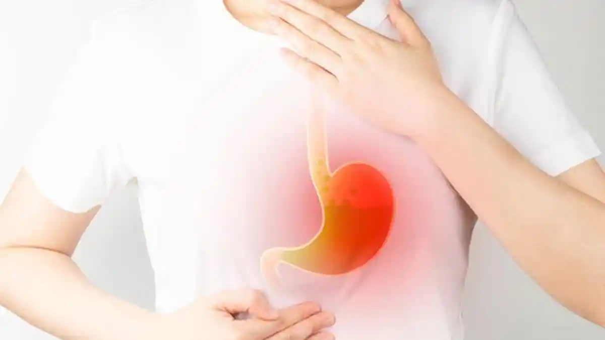 Khawatir Asam Lambung Naik saat Puasa? Simak Penyebab dan Tips Meminimalisir GERD