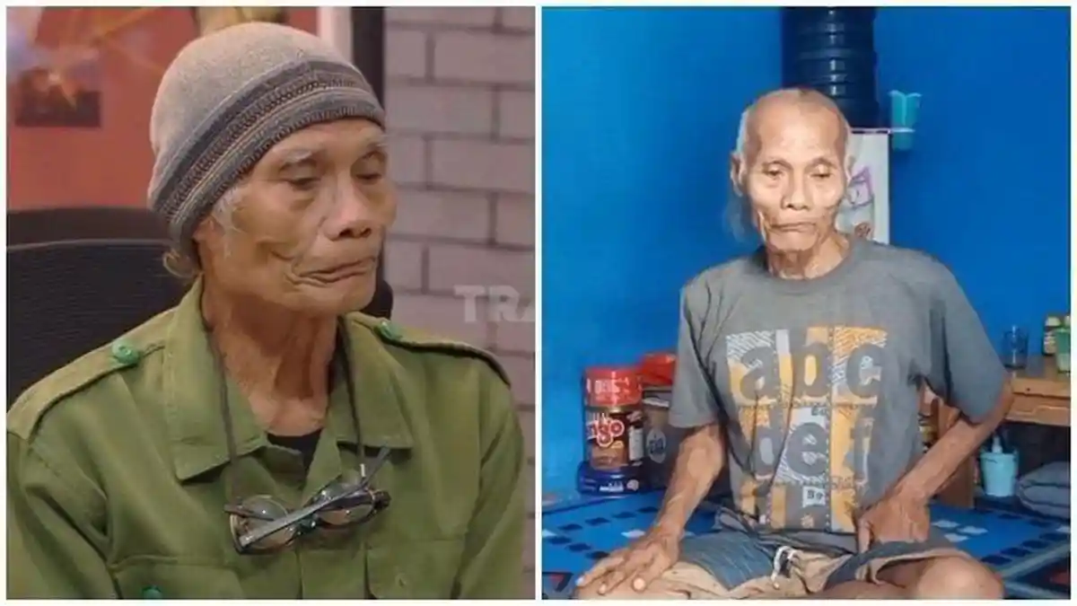 Ingat Boneng Hansip Warkop DKI Era 90-an? Dulu Sukses, Kini Hidupnya Memprihatinkan