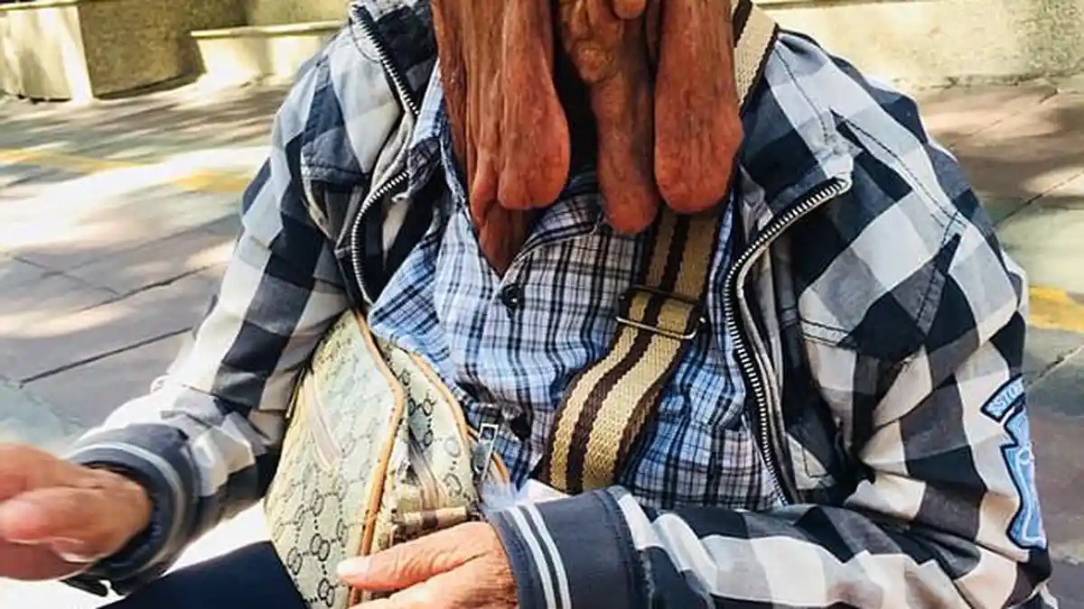 Menyayat Hati, Nenek ini Menolak Disembuhkan, Alasannya Bikin Terharu