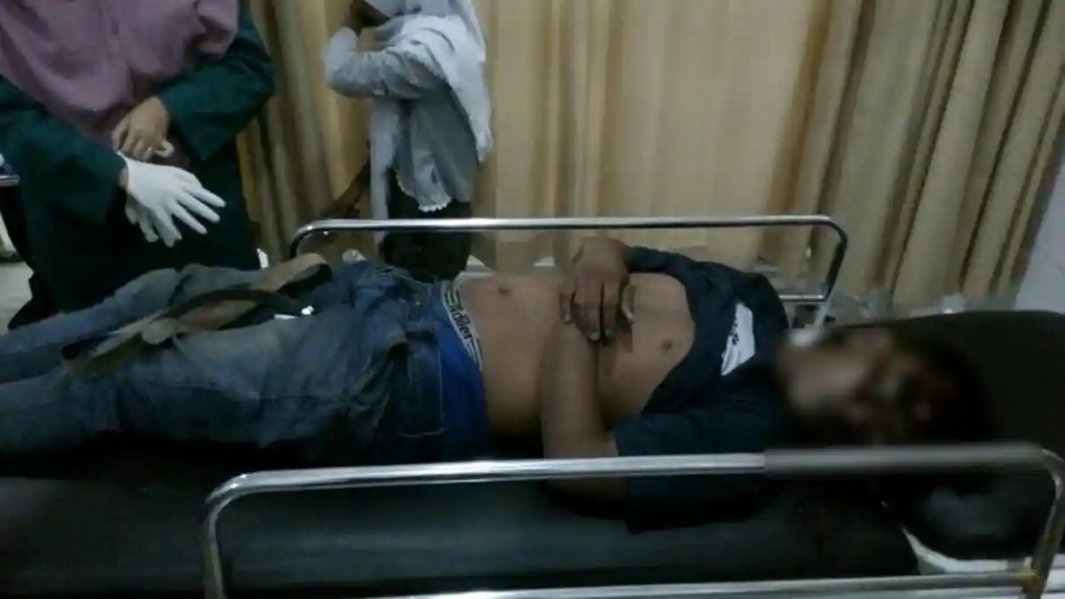 Sadis! Coba Pertahankan Motor, Kepala Apri Ditembak Begal di Kelurahan 13 Ulu Palembang
