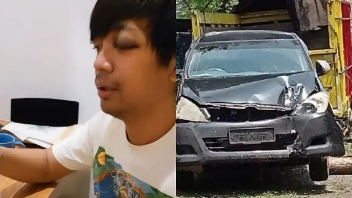 TETAP Manggung setelah Kecelakaan, Rian D'Masiv Beber Kondisi, Minta Maaf: Semoga Tidak Mengecewakan