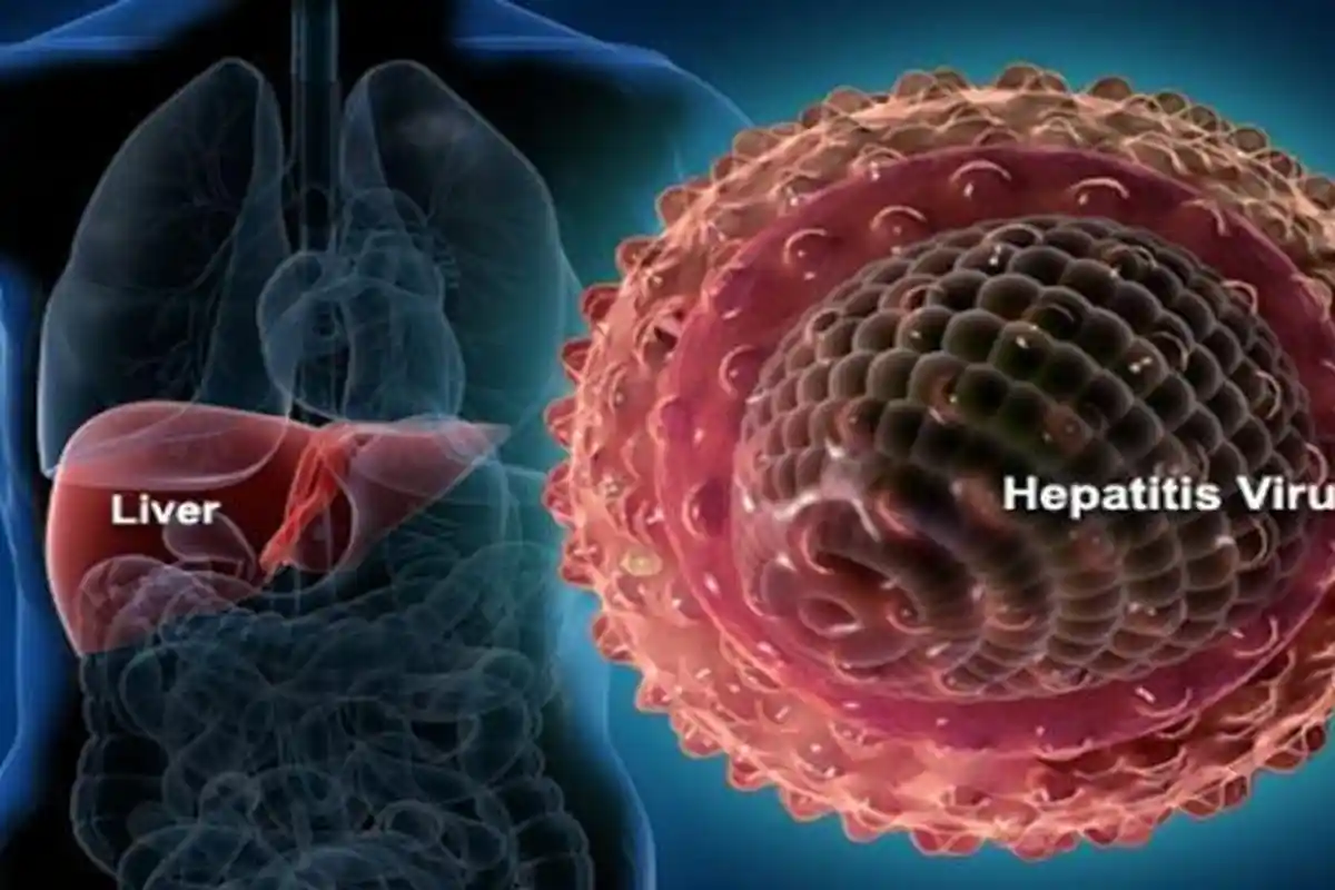 Hipotesa Epidemiolog: Hepatitis Akut Miterius pada Anak bagian dari Pandemi: Bentuk Long Covid-19