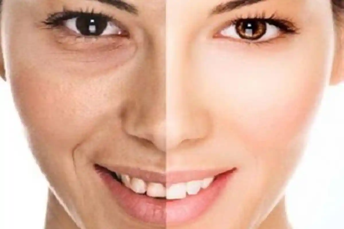 Yuk Praktek ! Cegah Kulit Kering dan Kusam di Musim Hujan dengan 7 Tips Praktis Berikut