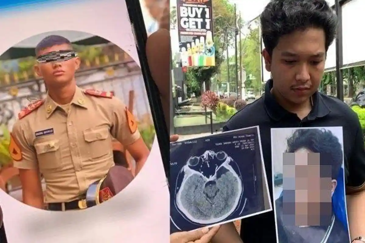 Sosok ZN Taruna Akmil Diduga Aniaya Mahasiswa UISU Medan Hingga Bonyok, Tawari Uang Damai Rp 15 Juta