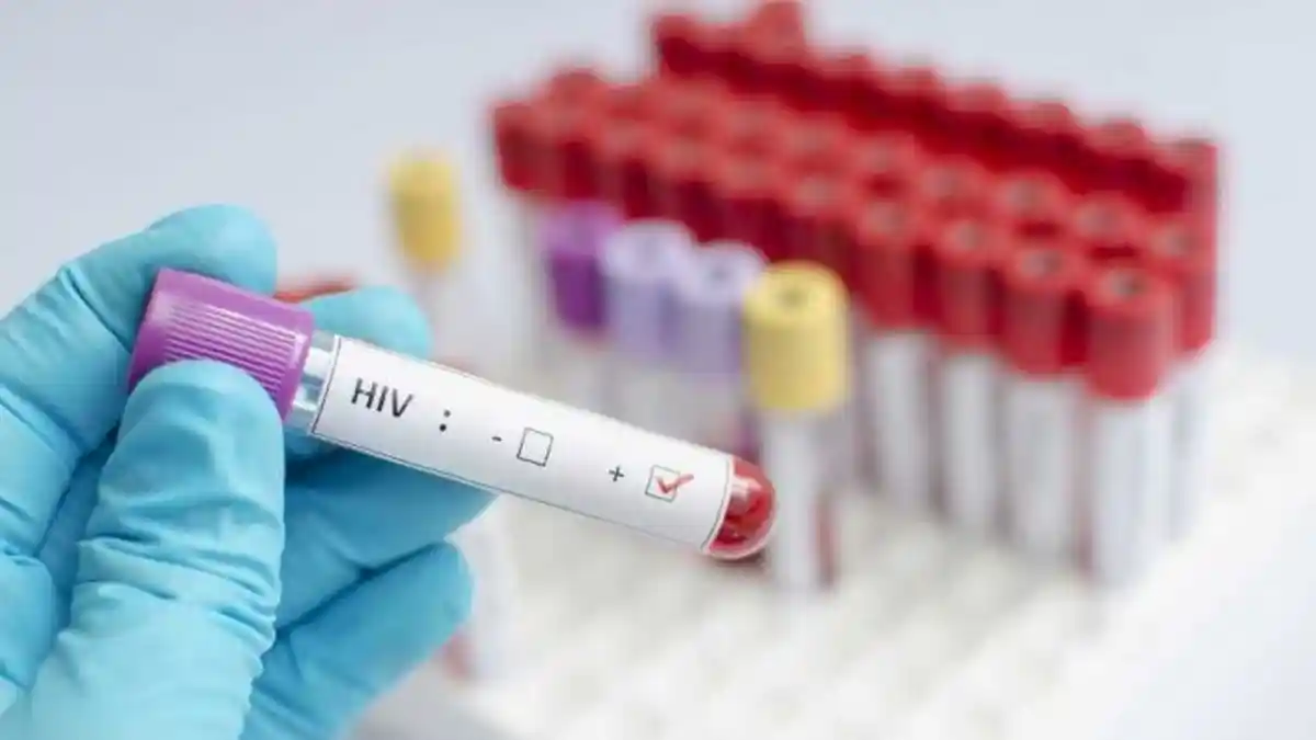 Mengerikan! Perilaku Seks LGBT Paling Cepat Menularkan HIV