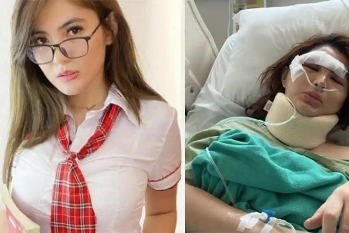 Angela Lee Gelar Sayembara Saat Masih Terbaring Sakit Usai Kecelakaan, Janji Siapkan Imbalan