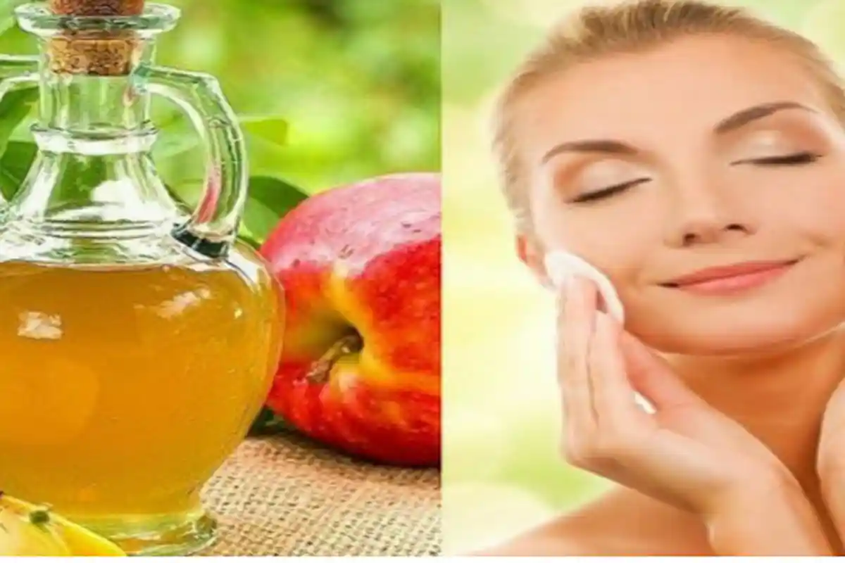 Dokter Spesialis Kulit: Jangan Oleskan Cuka Apel Pada Wajah, Ini Risikonya Jika Anda Lakukan!