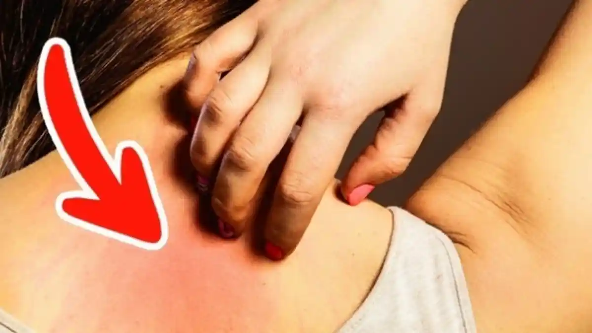 Bertambah 4 Kasus Baru Hepatitis Akut Luar Jakarta, Terjadi Sindrom Kuning Pada Anak
