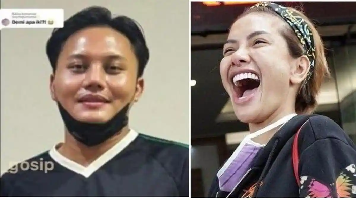 Sindiran Nikita Mirzani ke Para Artis Alasan Operasi Hidung Karena Penyakit Sinus: Dibikin Mancung