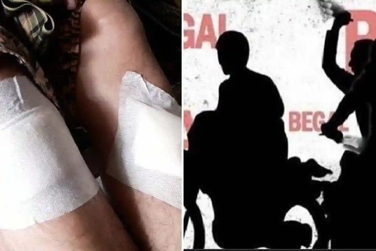 Diamuk Begal Sampai Luka-luka, Warga Ramai Tak Ada yang Membantu, Hanya Menjadikan Itu Tontonan Pagi