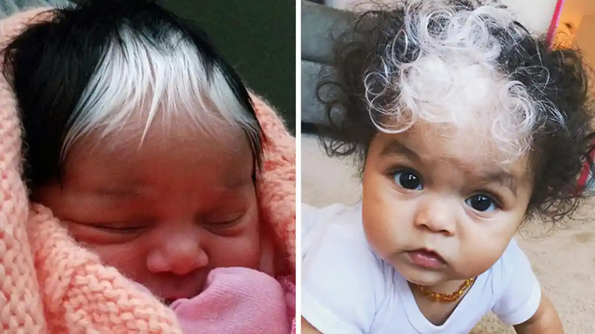 Bayi di Amerika Serikat Ini Lahir dengan Rambut Putih dan Tanda Lahir yang Mengejutkan